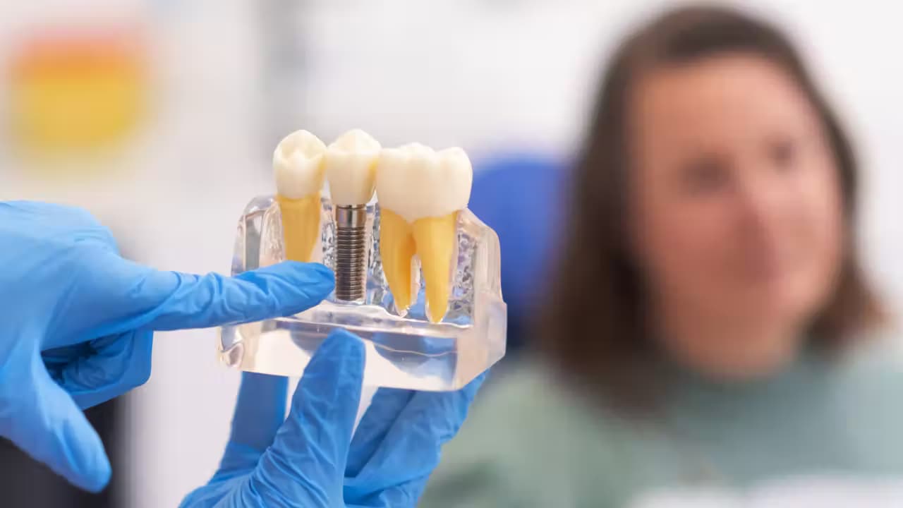 What to Expect During Your Dental Implant Procedure