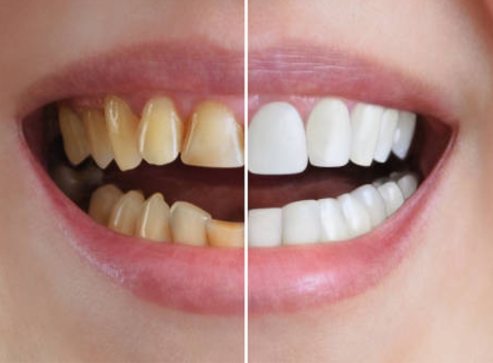 Cosmetic Dentistry