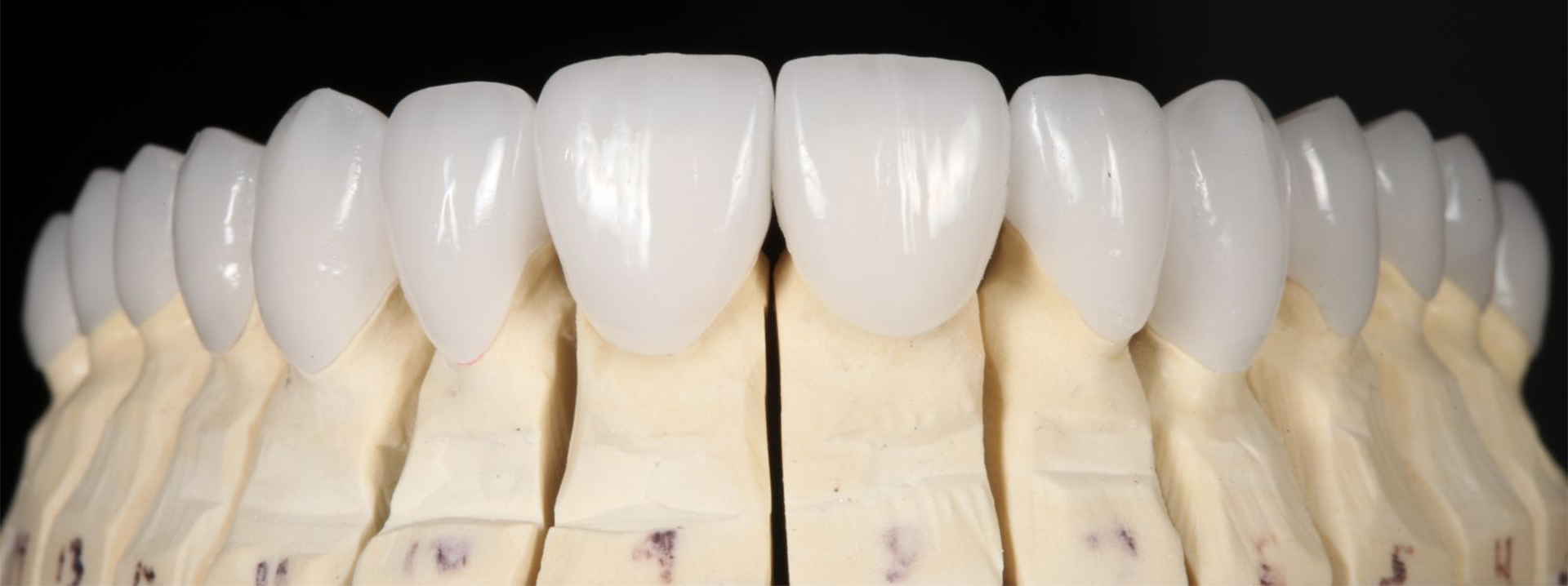 Dental Lab Work