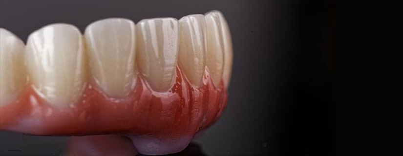 Dental Lab Work
