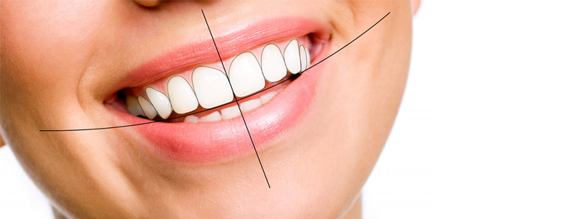 Smile Designing