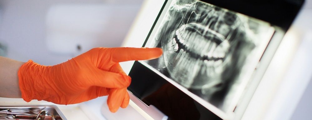 Tooth Vitality Test