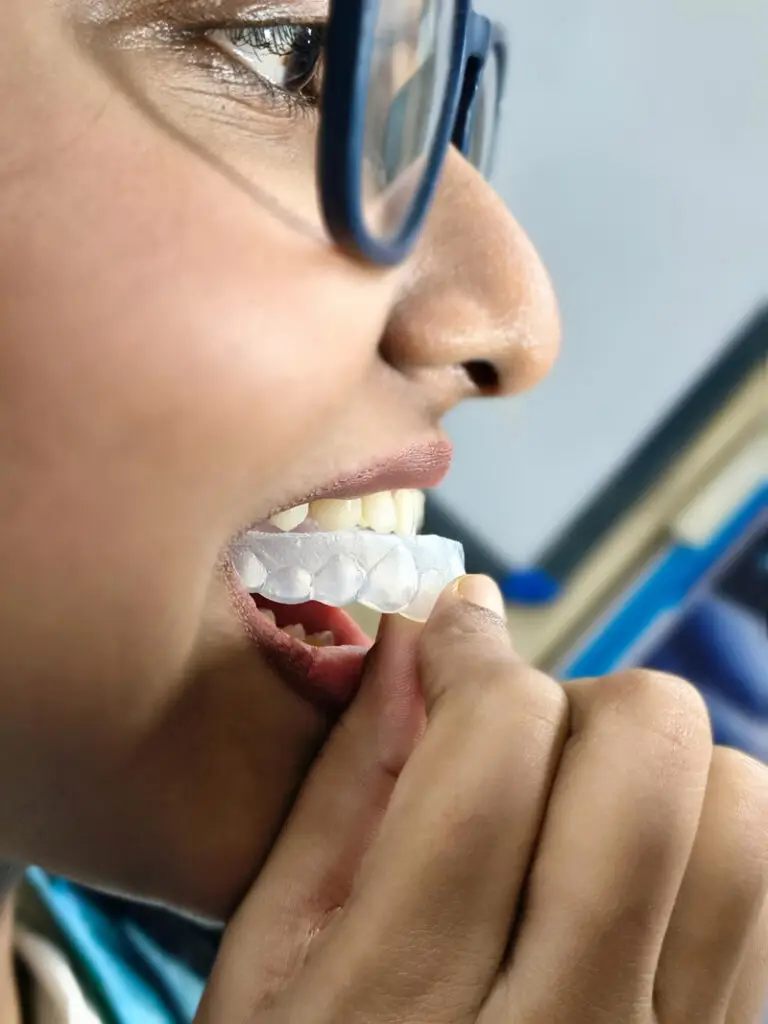 Best Jaw Joint Disease Releaving Bite Guard or Night Guard in Kolkata