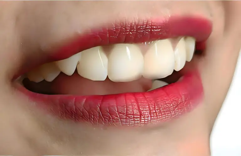 Best Teeth Cleaning Dentist in Kolkata
