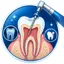 Best RVG Supported and Microscopic Root Canal Treatment Therapy in Kolkata