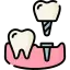 Best Dental Implant Treatment in Kolkata