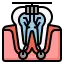 Best Root Canal Treatment in Kolkata