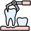 Best Teeth Extraction in Kolkata