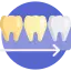 Best Teeth Whitening Treatment in Kolkata
